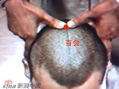 艾灸常用的保健穴有哪些？--百會(huì)