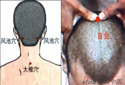 常見病艾灸時(shí)怎樣選穴？--大椎百會(huì)穴