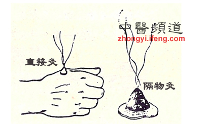 點(diǎn)擊將在新窗口查看全圖 溫補(bǔ)脾胃用艾灸 男女老少都適用