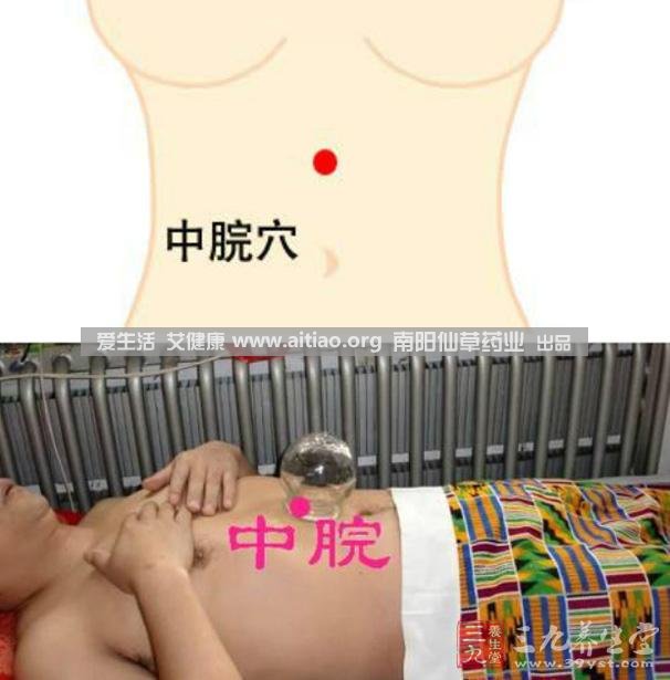 中脘穴位于腹部正中線，臍上4寸的位置上。每天艾灸10-15分鐘，能有效緩解胃部不適的癥狀，同時(shí)有助于祛濕。