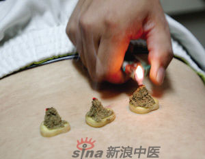 灸法的種類(lèi)  你知道多少？