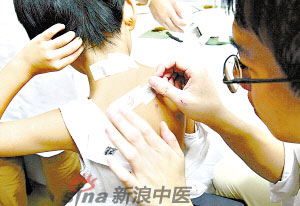 灸法的種類(lèi)  你知道多少？